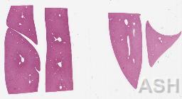 Test Image AT1