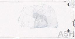 ATLAS 04 June 10-17