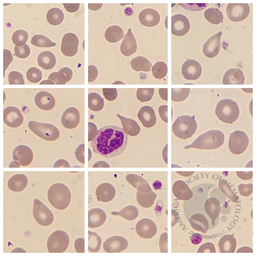 Tear Drop Cells