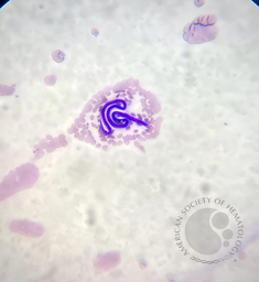 Microfilaria larvae 1