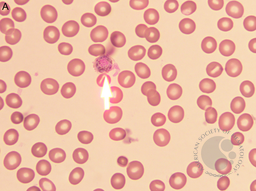 Plasmodium vivax gametocyte 1