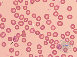 Plasmodium vivax multiple lifecycle stages