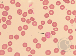 Plasmodium vivax gametocyte 2