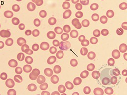 Plasmodium vivax trophozoite