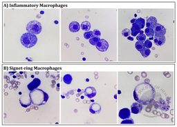 Macrophage in BALF