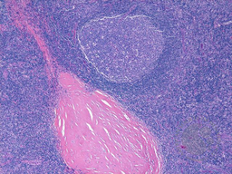 Image B