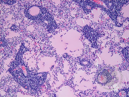 Image B