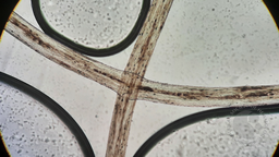 Image 2: Chediak-Higashi hair shaft
