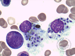 Amastigotes of Leishmania
