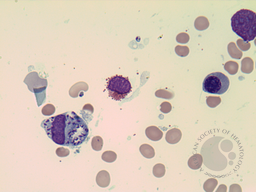 Leishmania amastigotes