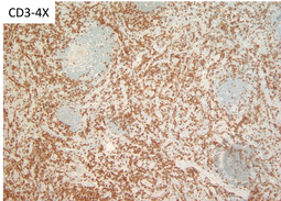 TAFRO- CD3