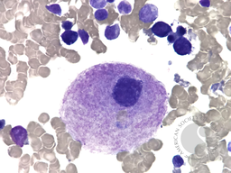 Hypolobated Megakaryocyte