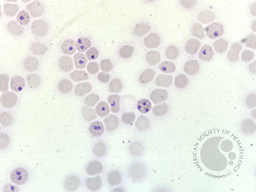 Plasmodium falciparum trophozoites