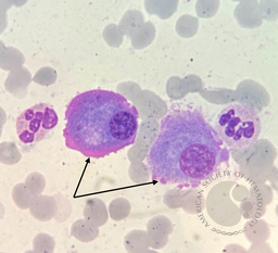 Flame cell