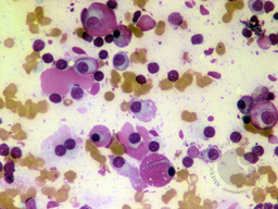 Flame cells 1
