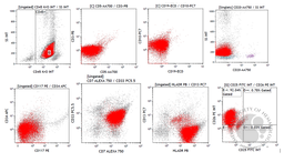 Blastic Plasmacytoid Dendritic Cell Neoplasm 4