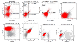 Blastic Plasmacytoid Dendritic Cell Neoplasm 5