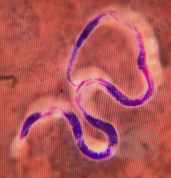 Microfilaria in buffy coat smear