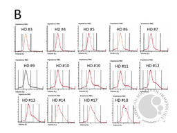 TTP - RBC histogram over time