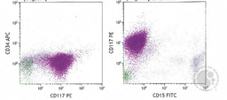 Bone marrow morphology and flow cytometry plots 3