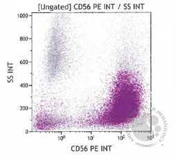 Bone marrow morphology and flow cytometry plots 5