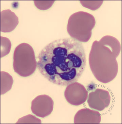 Critical Green Inclusions 2