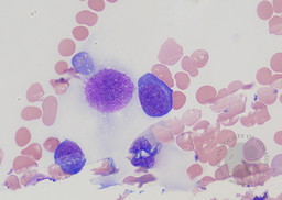 A- Proerythroblast