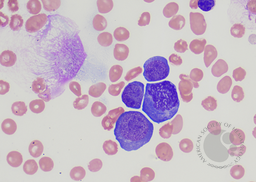 B- Erythroid precursors at different stages