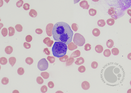 C- Basophilic erythroblast and mitosis