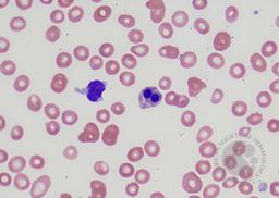 F- Binucleated forms