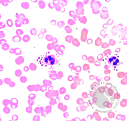 Platelet Satellitism