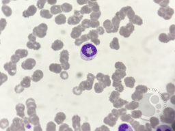 Ring neutrophil 2