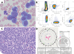 CD5-positive high-grade B-cell lymphoma with MYC, BCL2, and BCL6 rearrangements