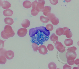 Fungal organisms in a leukocyte on a peripheral blood smear