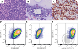 Blastic plasmacytoid dendritic cell neoplasm in the absence of cutaneous involvement