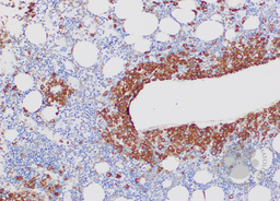 Bone marrow trephine myeloperoxidase stain (10 x hpf)