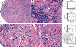 Seeing is believing: a histology textbook’s dream case of sarcoidosis