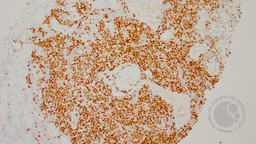 PAX 5 stain
