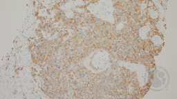 CD5 stain