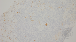 CCND1 stain