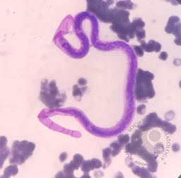 A NIGHT PROWLER - MICROFILARIA IN PERIPHERAL SMEAR