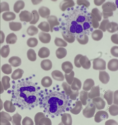 Platelet Satellitism 2
