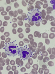 Platelet satellitism 1