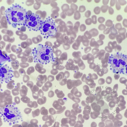 Platelet satellitism 2