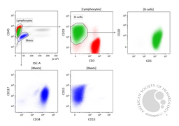 Simultaneous Occurrence of Chronic Lymphocytic Leukemia and High-Grade Therapy-Related Myeloid Neoplasm: Flow Cytometry, Cytogenetics and Molecular Fi
