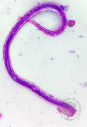 Silent Passenger: Asymptomatic Microfilaremia Unmasked by Eosinophilia