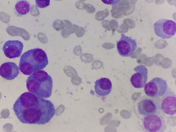 Binucleate plasma cell
