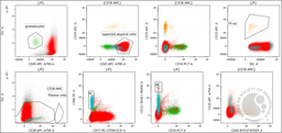 Flowcytometry of Blastoid cells shows high side scatter with CD45 bright