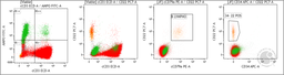 Flowcytometry shows positivity for Cytoplasmic CD3