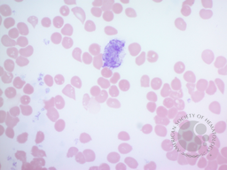 Vacuolated Erythrocytes Figure 1(b)